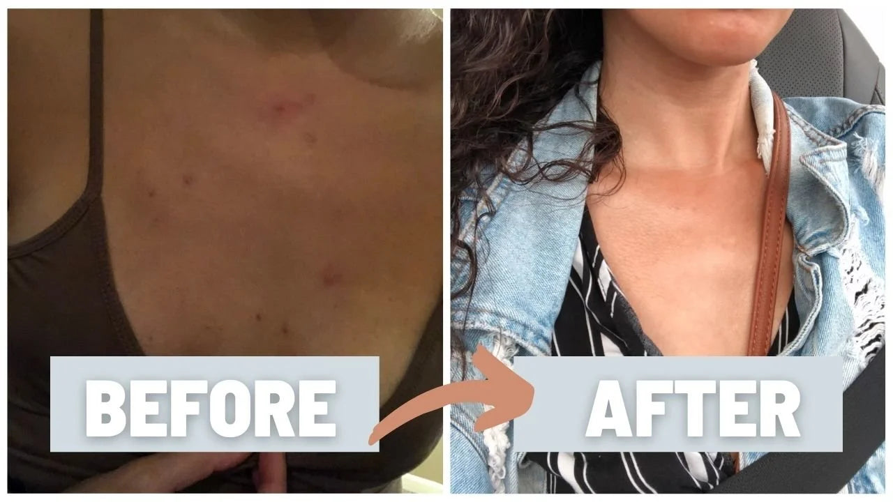 BOGO SALE! Unblurred Calming & Clearing Beauty Serum-1